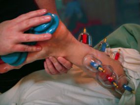 Reflexology with Cupping